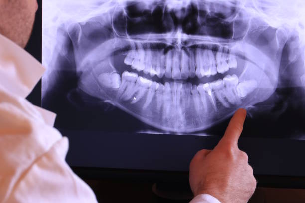 Best Emergency Tooth Extraction  in Richmond, KY