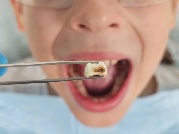 Best Broken Tooth Emergency  in Richmond, KY